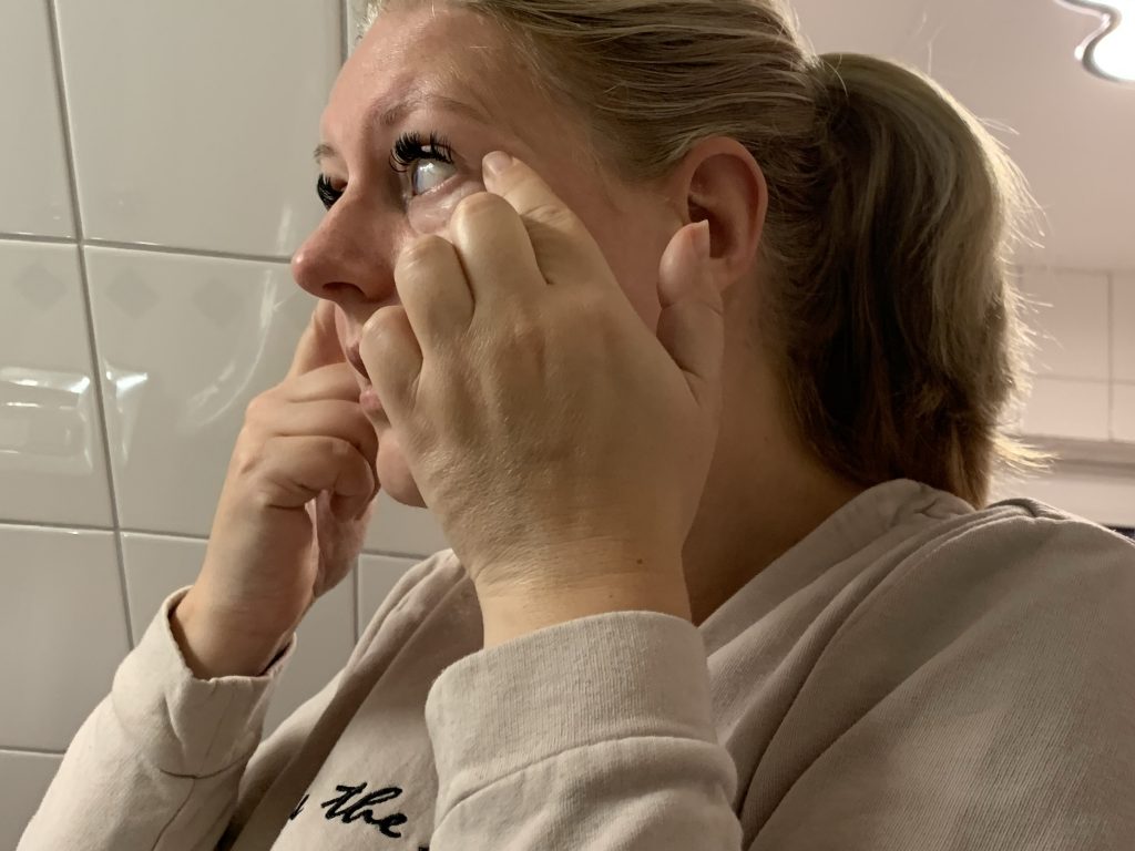 biodermal tegen wallen en donkere kringen