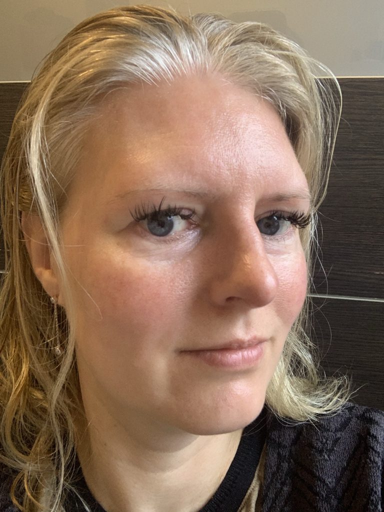 biodermal tegen wallen en donkere kringen