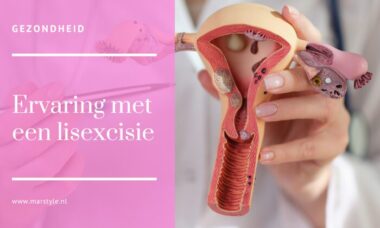 lisexcisie ervaring